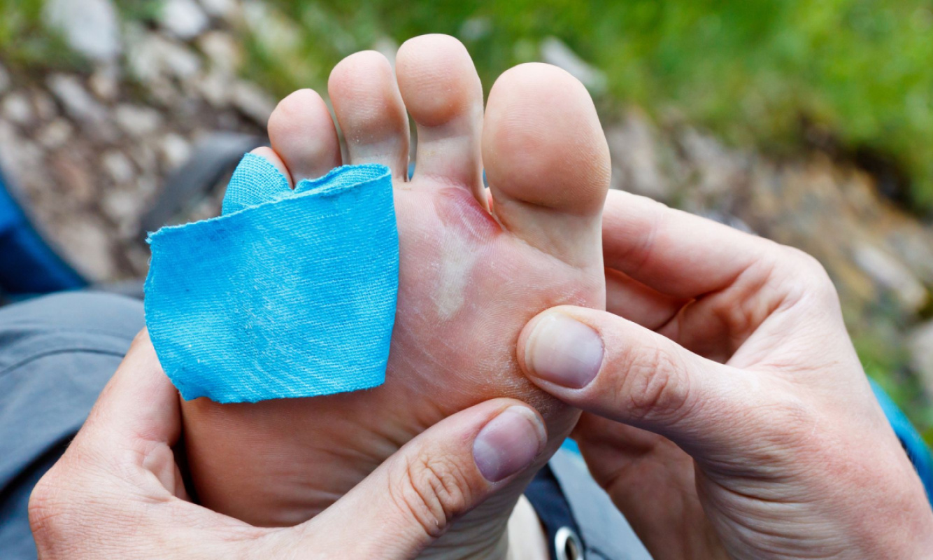Blasen beim Wandern